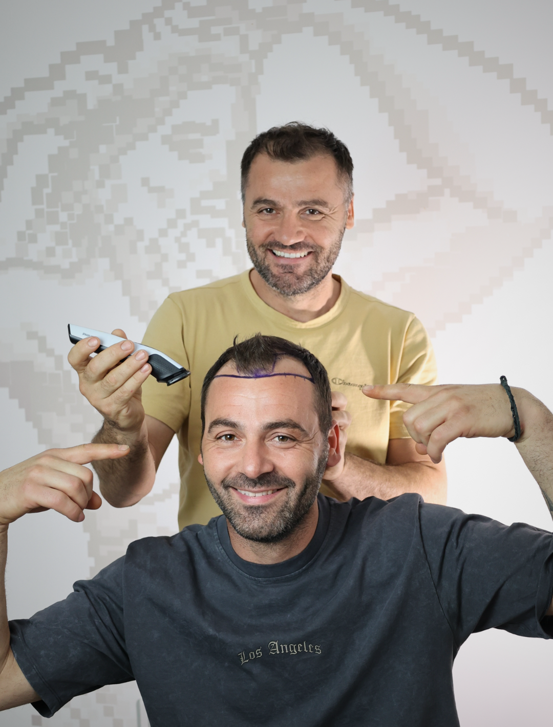 Klinika e mbjelljes së flokëve në Tiranë - Dermolife