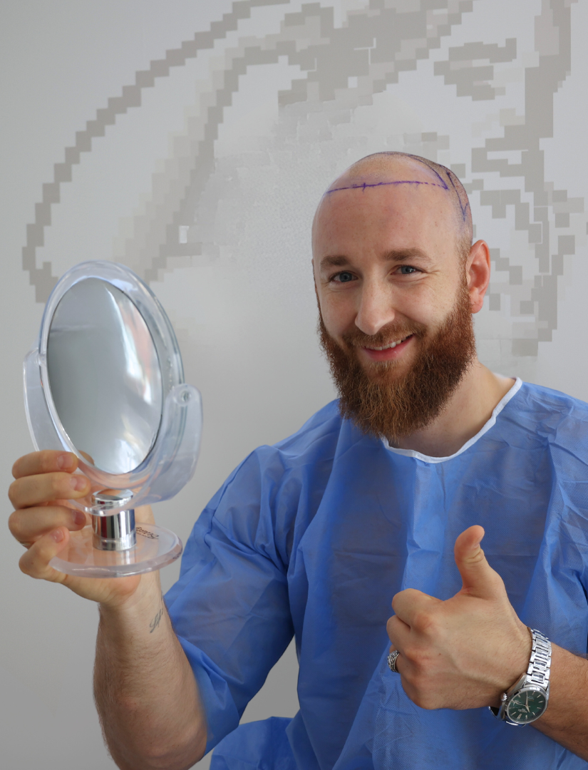 Faza përgatitore e transplantit të flokëve