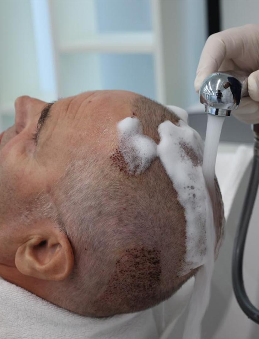 Kujdesi pas procedurës – larje e kokës