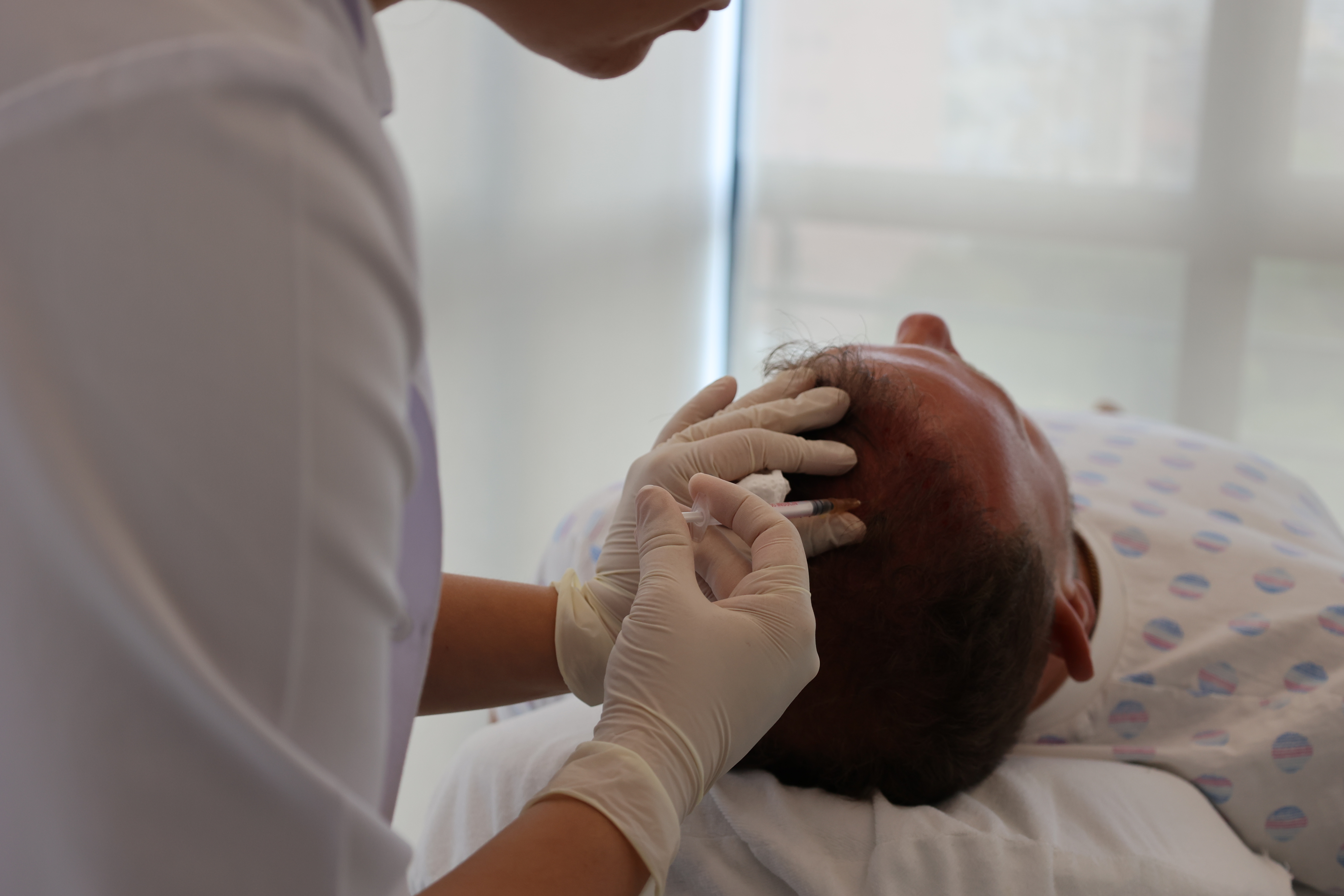 Terapia PRP për flokët